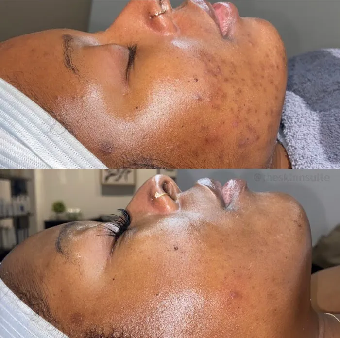 The Skin Suite Picture 4