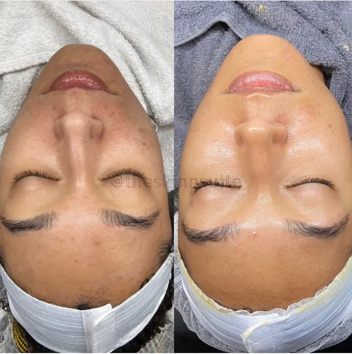 The Skin Suite Picture 2