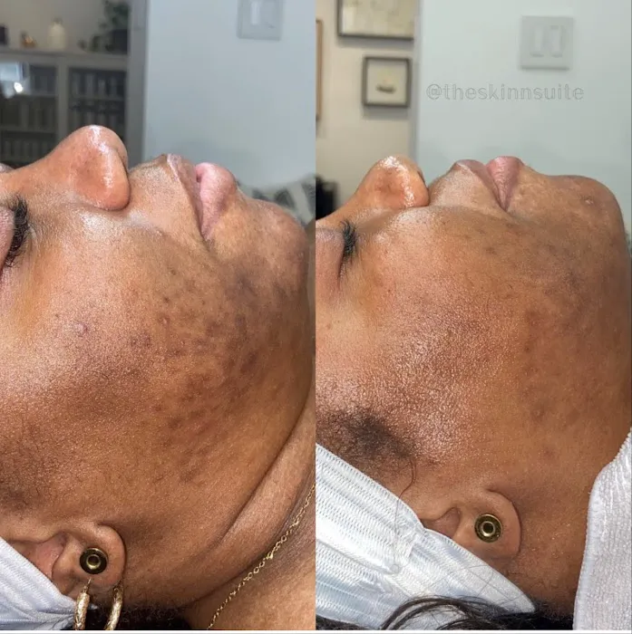 The Skin Suite Picture 6