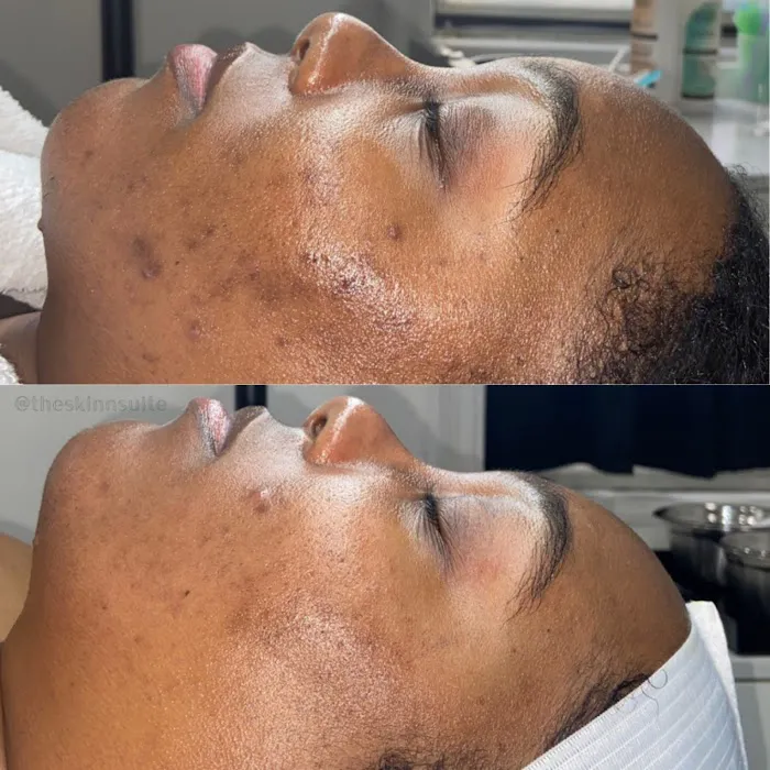 The Skin Suite Picture 5