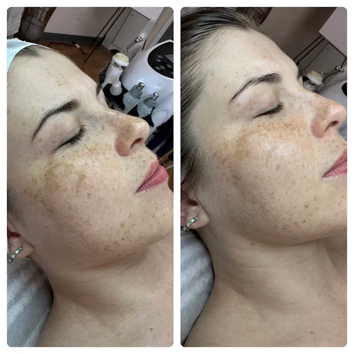 BananaBeautyNYC Picture 10