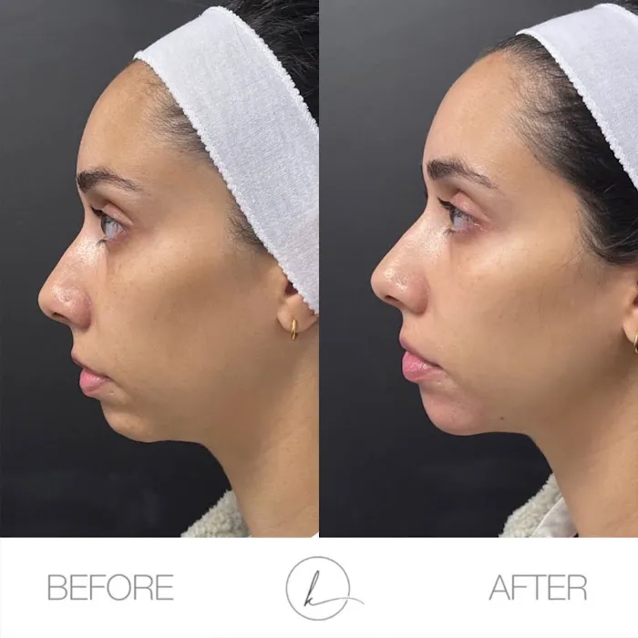 KHROM AESTHETICS Picture 3