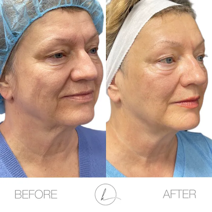 KHROM AESTHETICS Picture 9