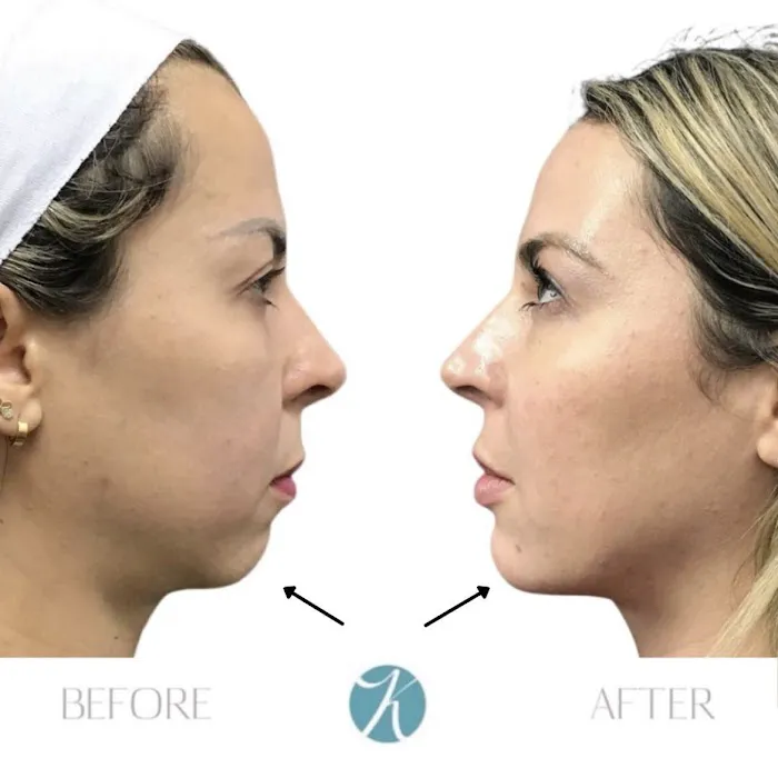 KHROM AESTHETICS Picture 5