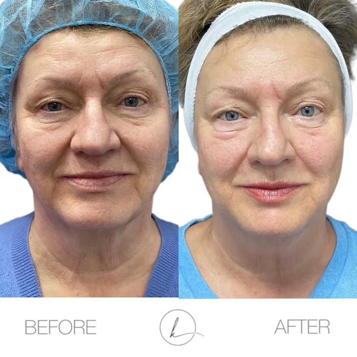 KHROM AESTHETICS Picture 8