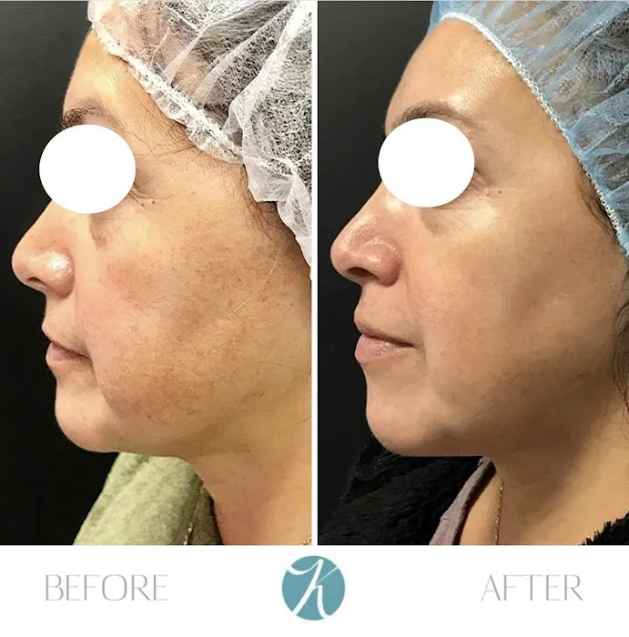 KHROM AESTHETICS Picture 7