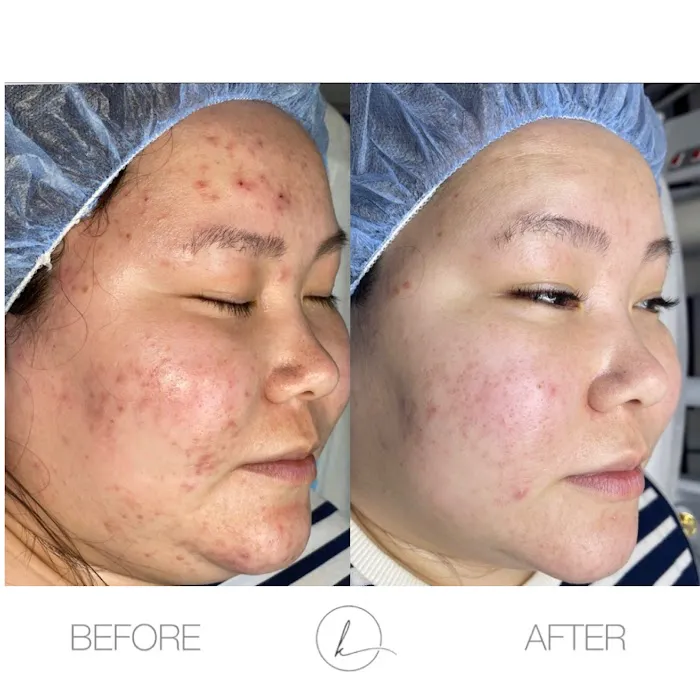 KHROM AESTHETICS Picture 6