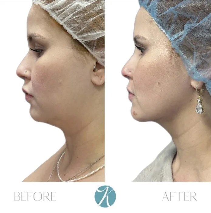 KHROM AESTHETICS Picture 10