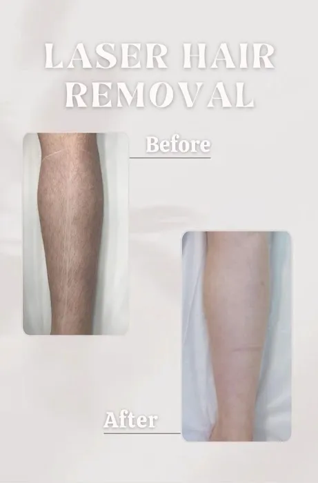 DERMALASE ESTHETICS Picture 5