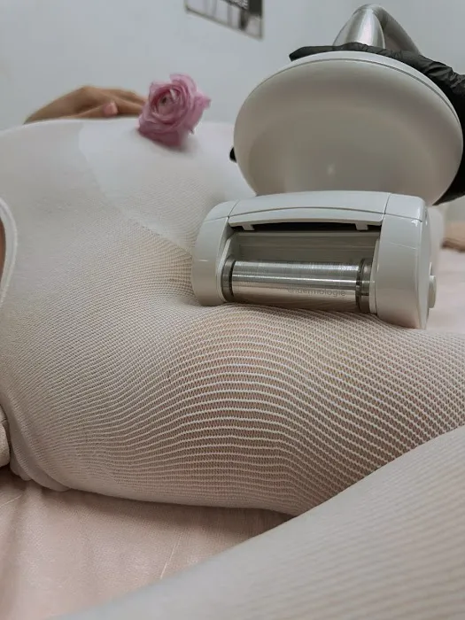 LPG Body Line Picture 10