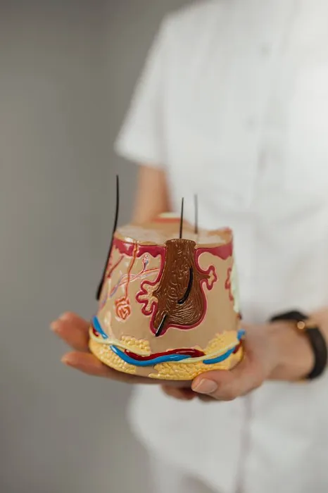 Acne Clinic NYC: hormonal, comedonal, inflamed, teen, PCOS acne Picture 9