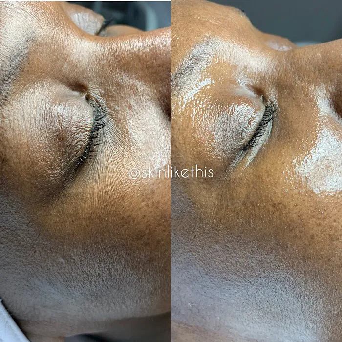 Skin Like This Picture 6