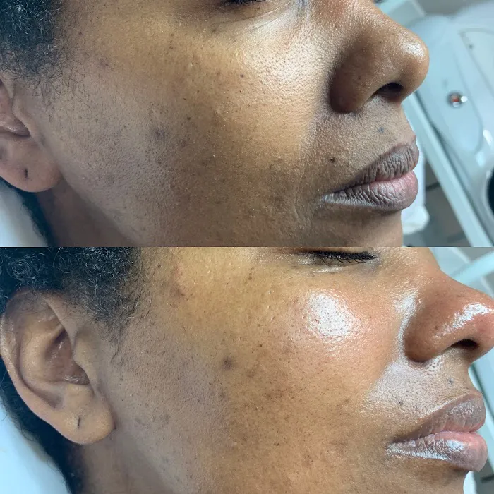 Skin Like This Picture 10