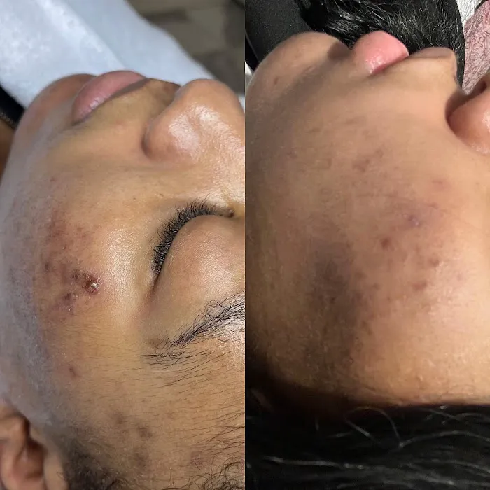 Skin Like This Picture 8