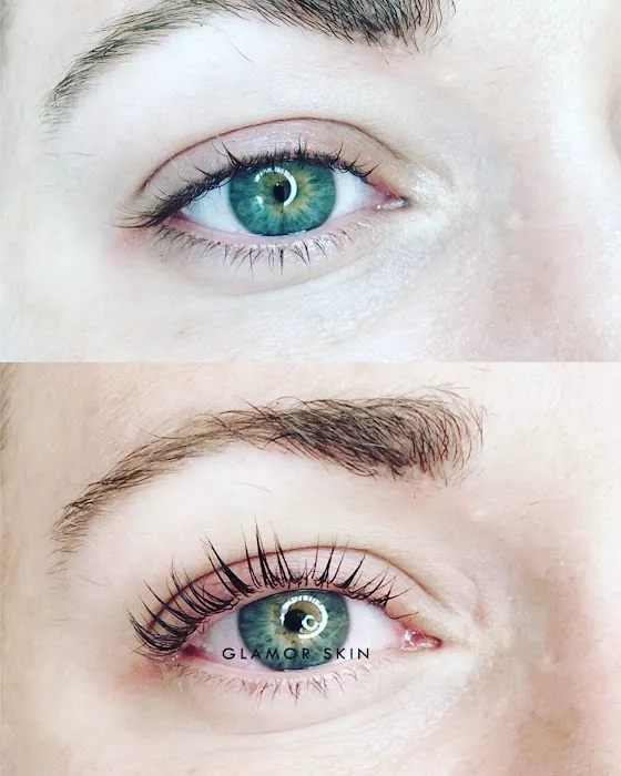 Glamor Skin Picture 3