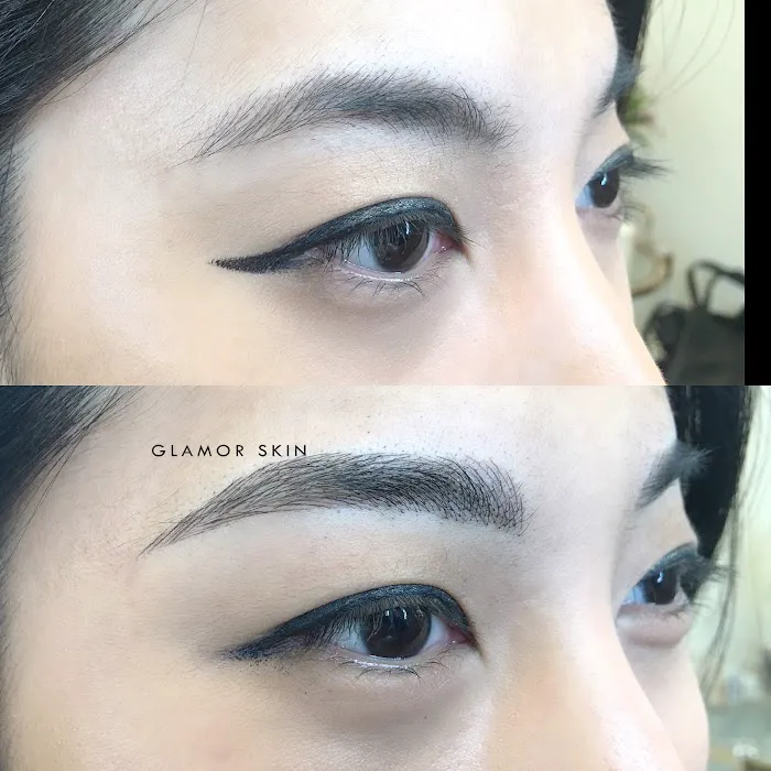 Glamor Skin Picture 5