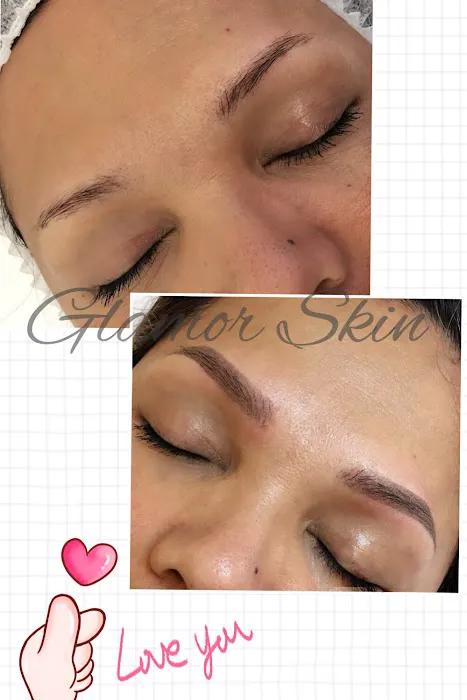 Glamor Skin Picture 4