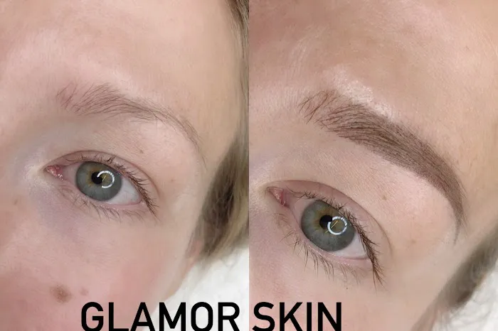 Glamor Skin Picture 6