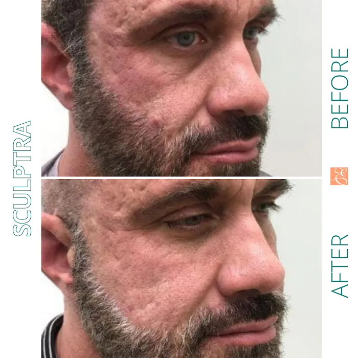 Studio Esthetique Skin & Laser Center Picture 4