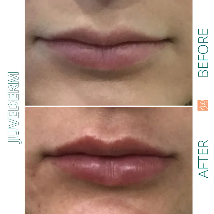 Studio Esthetique Skin & Laser Center Picture 6