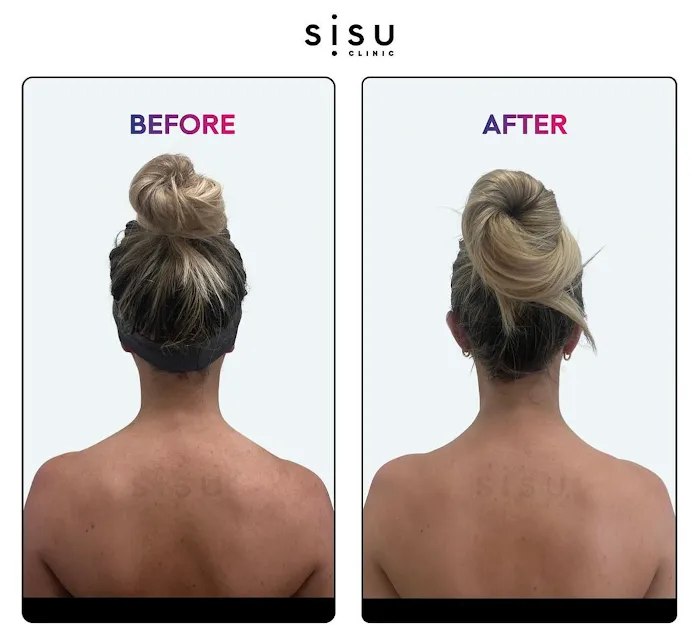 Sisu Clinic Soho | Doctor-led, Cosmetic Medicine & Treatments Picture 8