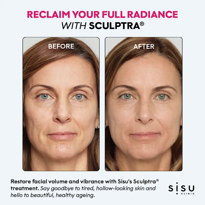 Sisu Clinic Soho | Doctor-led, Cosmetic Medicine & Treatments Picture 9
