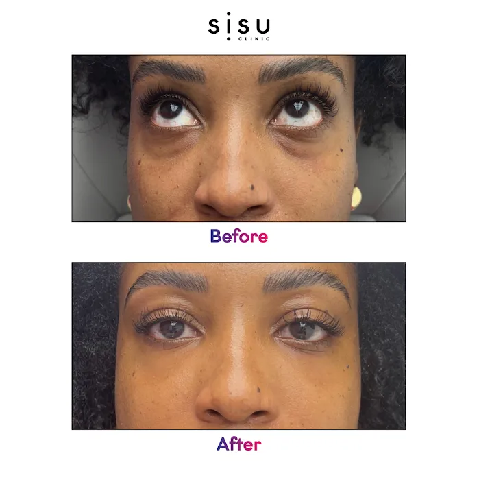 Sisu Clinic Soho | Doctor-led, Cosmetic Medicine & Treatments Picture 10
