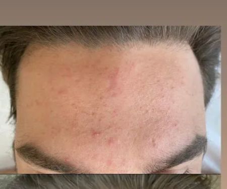 The Peel Connection NYC