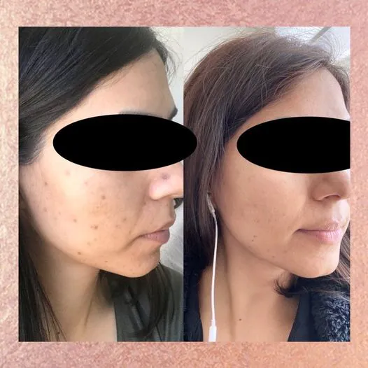 The Peel Connection NYC Picture 4