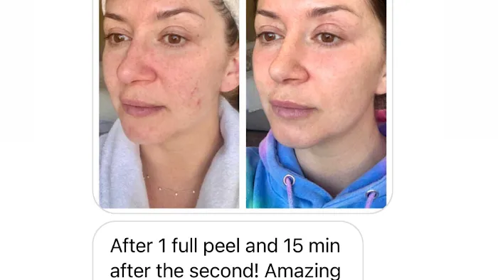 The Peel Connection NYC Picture 3