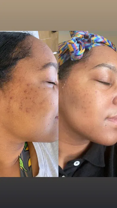 The Peel Connection NYC Picture 6