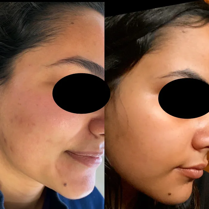 The Peel Connection NYC Picture 8