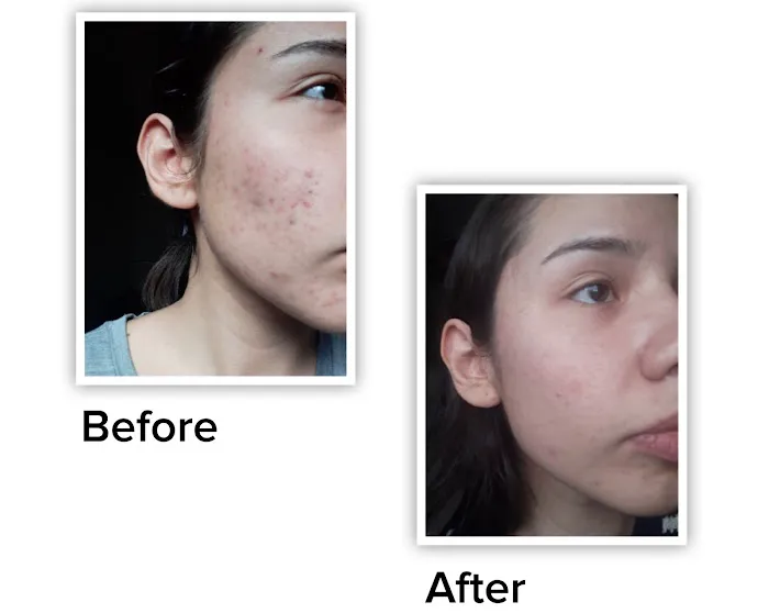 The Peel Connection NYC Picture 7