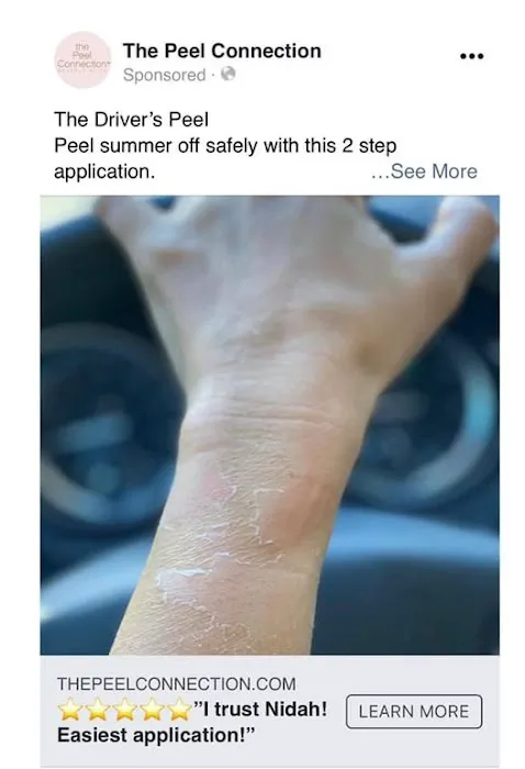 The Peel Connection NYC Picture 9