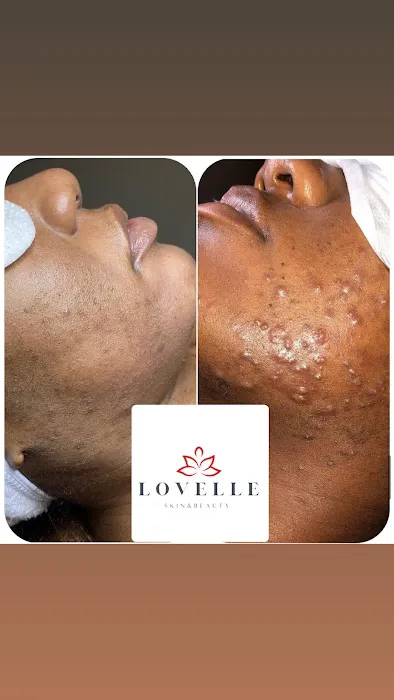 Lovelle Skin & Beauty Picture 1