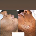 Lovelle Skin & Beauty