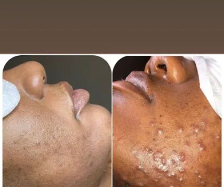 Lovelle Skin & Beauty