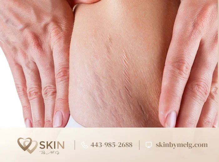 Skin By Mel G Picture 6