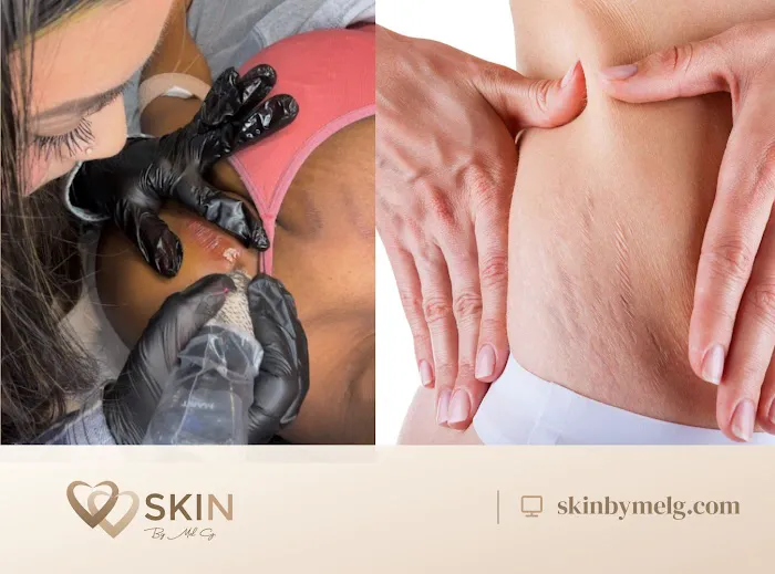 Skin By Mel G Picture 5