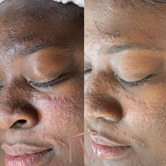 Flaws N Vanity Picture 2