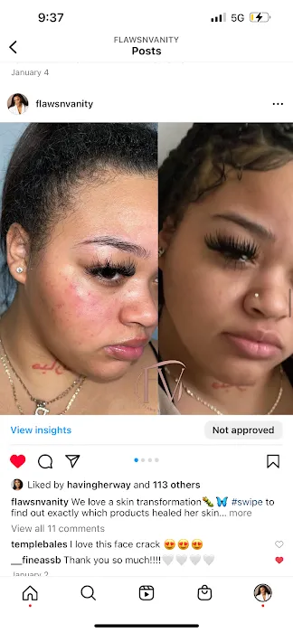 Flaws N Vanity Picture 5