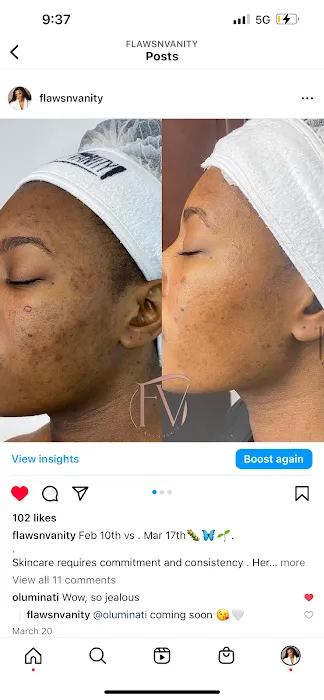 Flaws N Vanity Picture 8