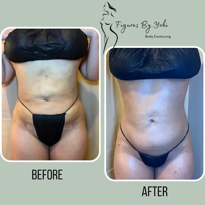 Figures by Yoki Picture 1