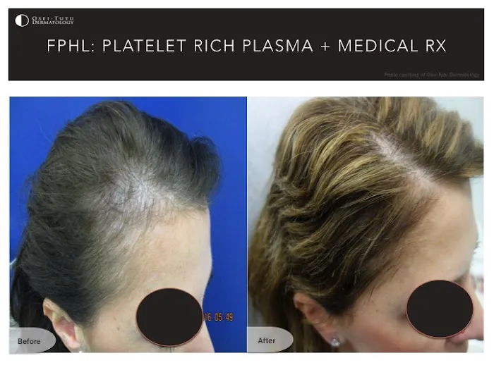 Osei-Tutu Dermatology & Hair Restoration Picture 1