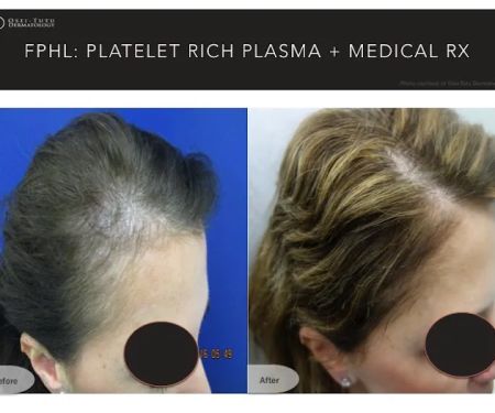 Osei-Tutu Dermatology & Hair Restoration