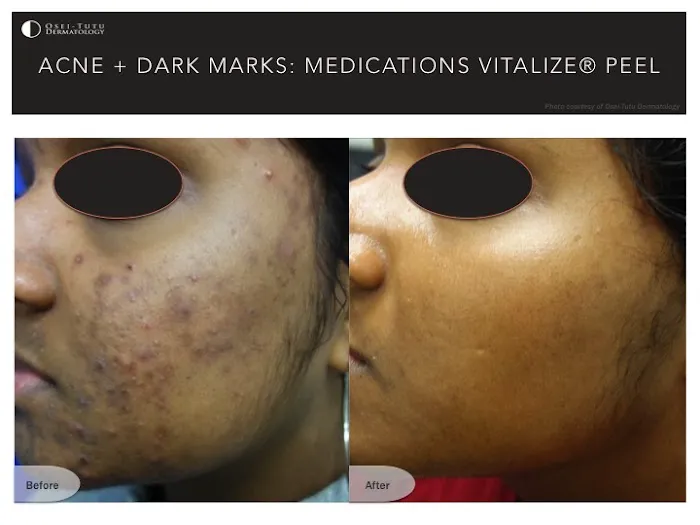 Osei-Tutu Dermatology & Hair Restoration Picture 8