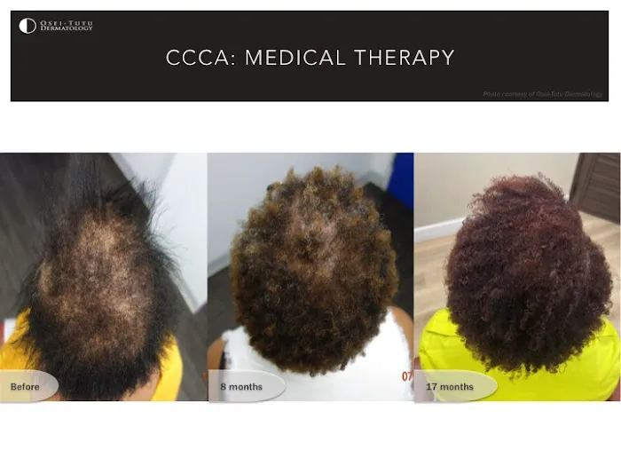 Osei-Tutu Dermatology & Hair Restoration Picture 5