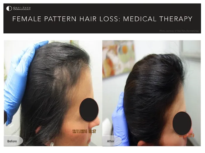 Osei-Tutu Dermatology & Hair Restoration Picture 6