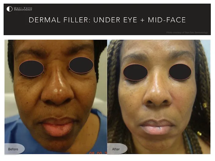 Osei-Tutu Dermatology & Hair Restoration Picture 7