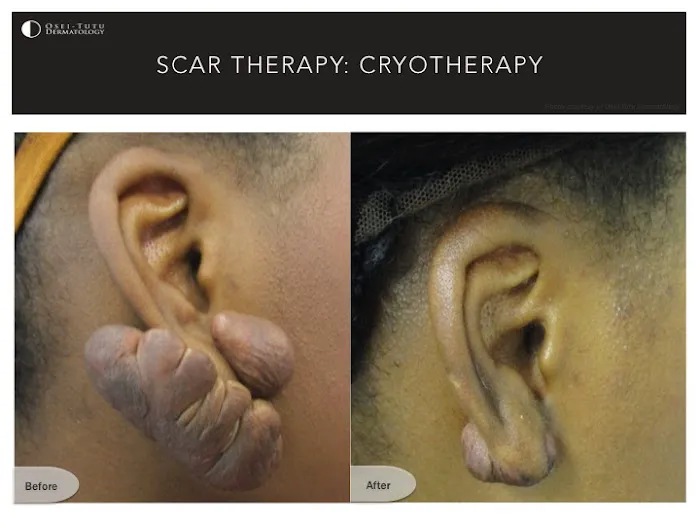 Osei-Tutu Dermatology & Hair Restoration Picture 4